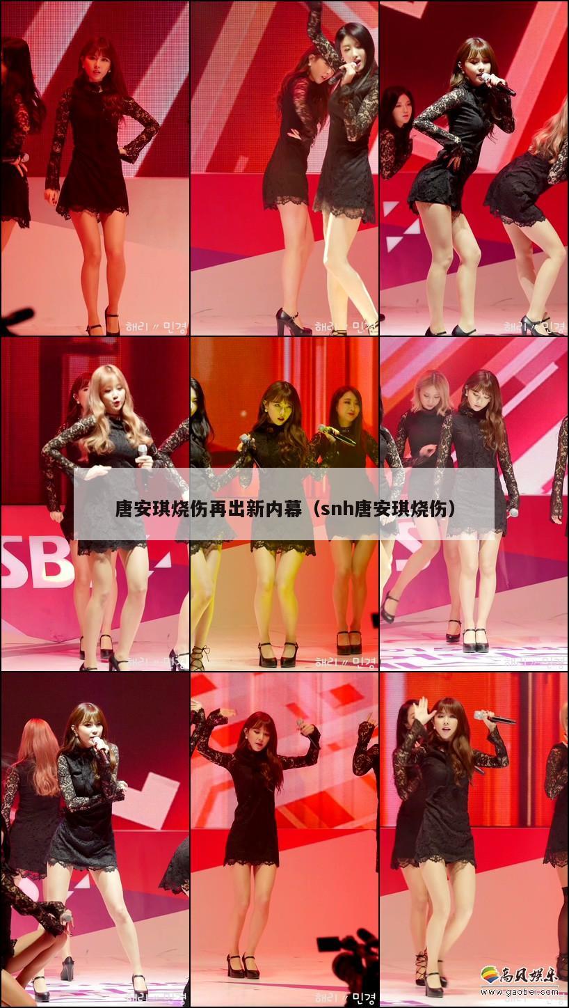 唐安琪烧伤再出新内幕(snh唐安琪烧伤) 第1张 唐安琪烧伤再出新内幕(snh唐安琪烧伤) 第1张