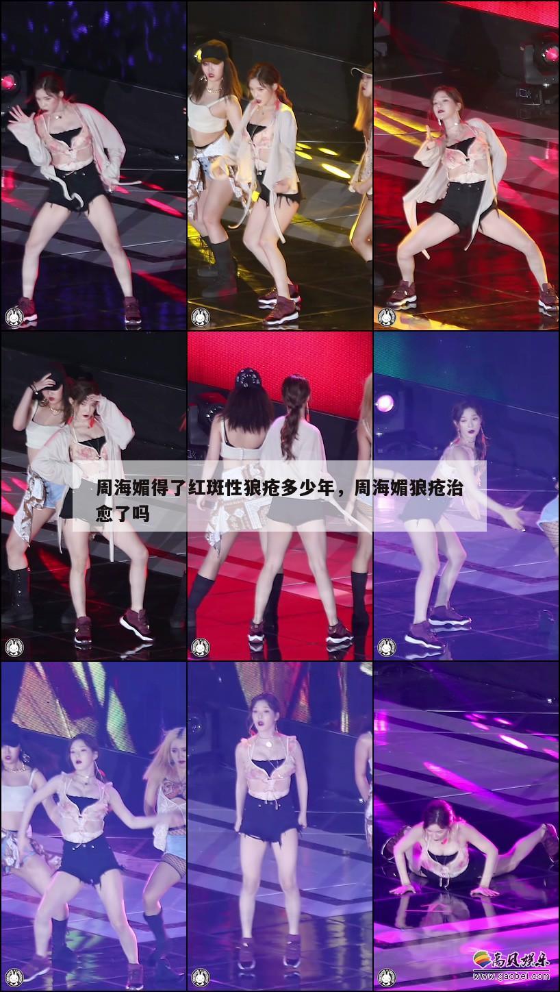 周海媚得了红斑性狼疮多少年,周海媚狼疮治愈了吗 第1张 周海媚得了红斑性狼疮多少年,周海媚狼疮治愈了吗 第1张